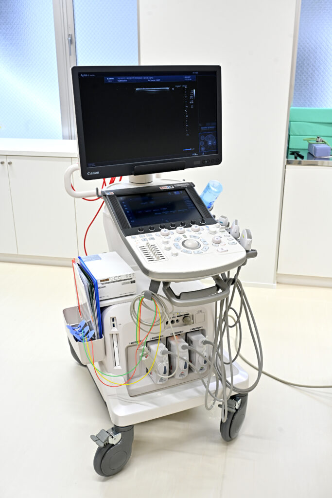 超音波検査装置